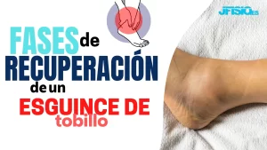 Fases de recuperación esguince 